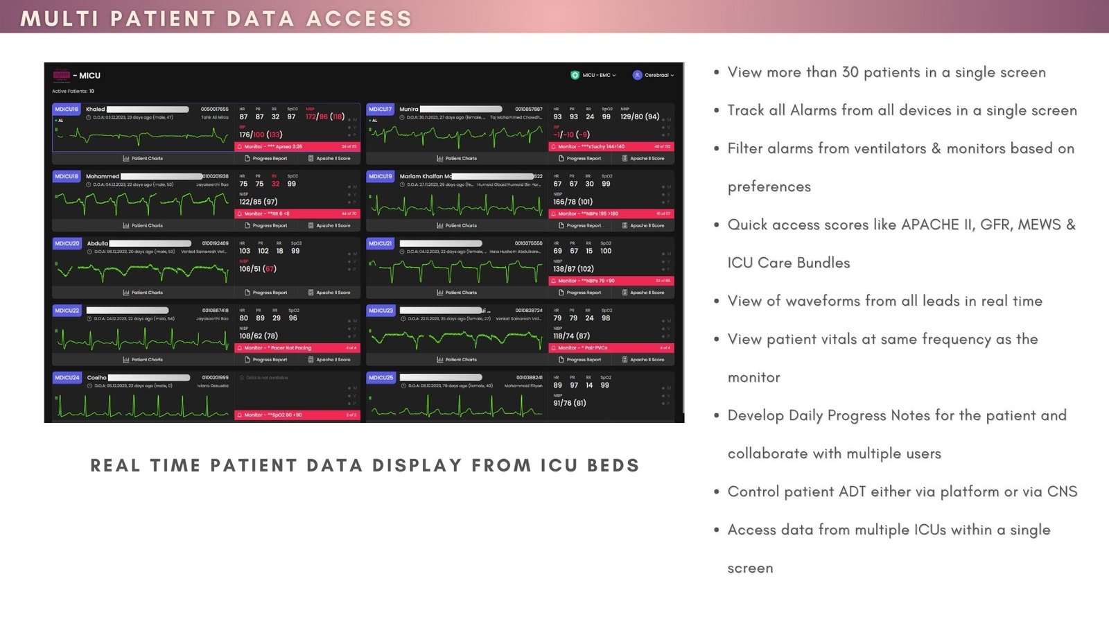 ICU Automation Software